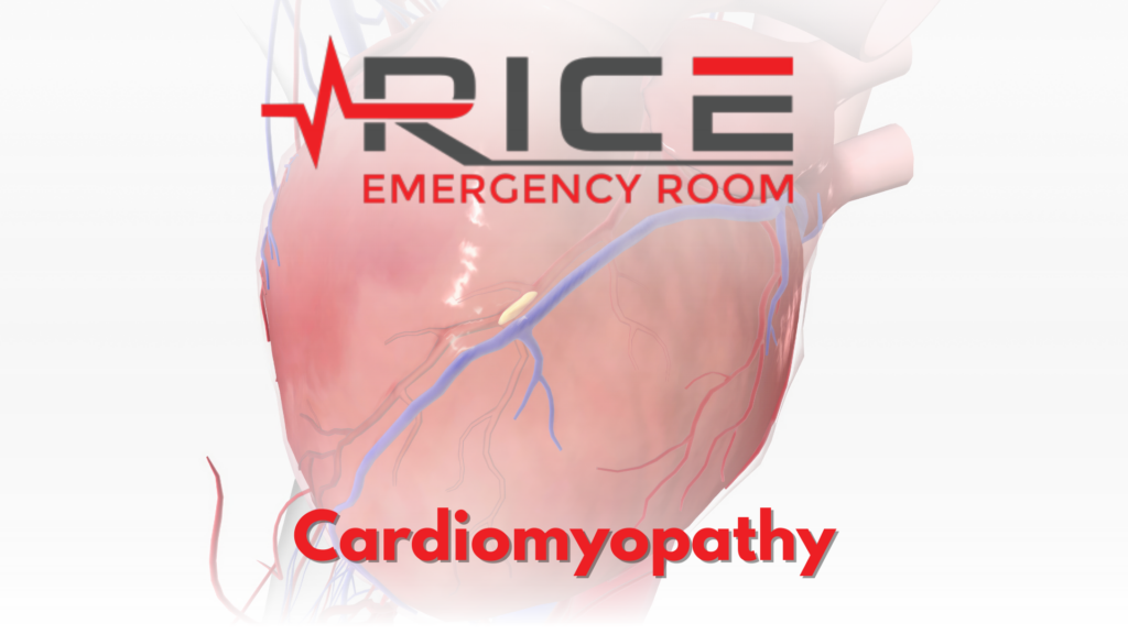 Cardiomyopathy