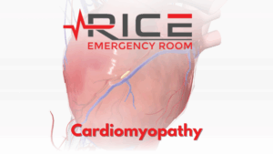 Cardiomyopathy: A Serious Heart Condition