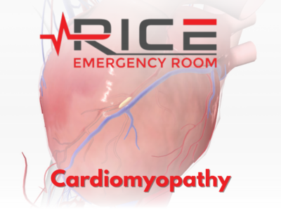 Cardiomyopathy