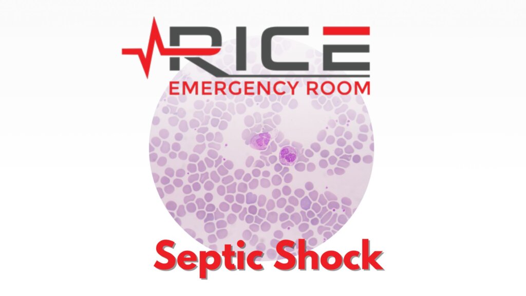 Septic Shock: Understanding Causes, Symptoms, and Treatments