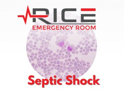 Septic Shock