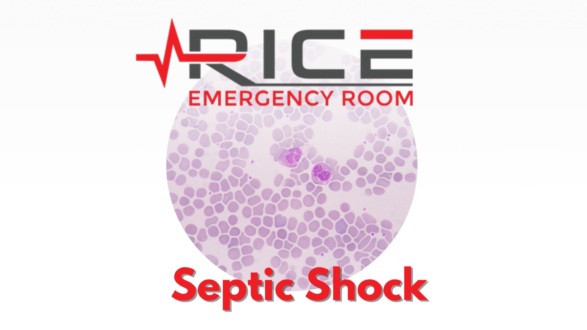 Septic Shock